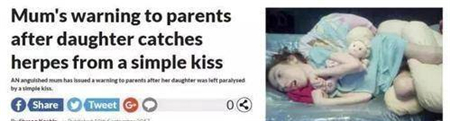 女孩突然瘫痪，只是因为出生时的一个吻