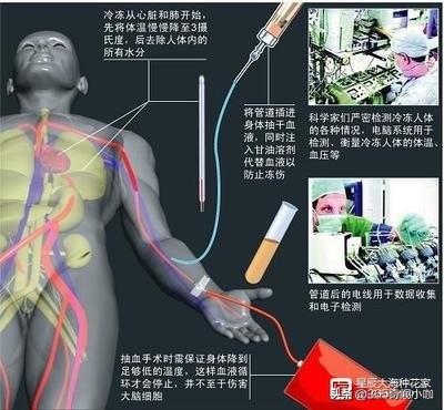 ：冰冻人沉睡53年，解冻结果曝光！人类永生不再是梦