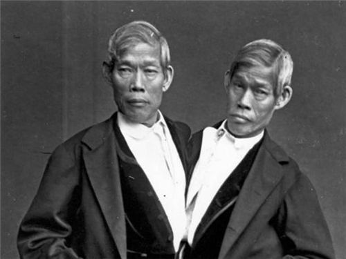 华裔连体兄弟，因身体特殊被展览，走红后娶一对姐妹，生22个孩子