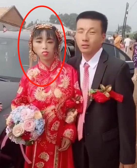 孩子|“鞋拔子”脸新娘结婚，丈夫生无可恋，网友：一个有债一个有矿