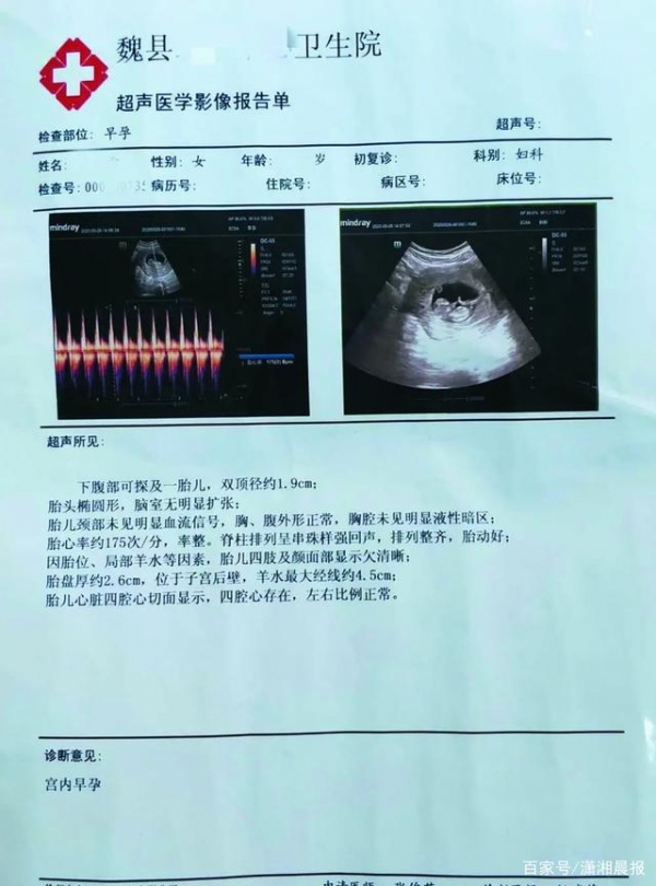 |精神病女患者住院期间和男护工“自愿”发生关系怀孕？