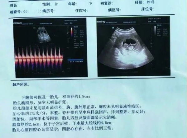 高娜 精神病院女患者与护工发生关系怀孕 女子丈夫：要媳妇但不接受孩子