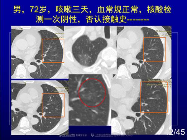 「病毒」新冠病毒到底从哪来？专家梳理了一大堆证据