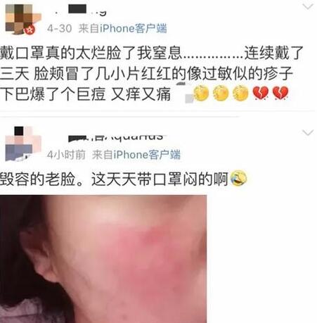 #口罩#小姐姐摘下口罩，当场大哭：医生，我还没男朋友怎么办?